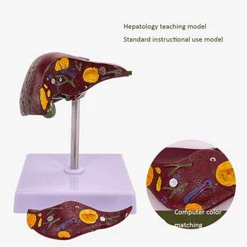 Патологичен модел на чернодробна мастна чернодробна склеротична чернодробна болест, трансформирана в анатомичен модел на човешкия черен дроб